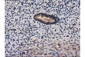 Image no. 9 for anti-Destrin (Actin Depolymerizing Factor) (DSTN) antibody (ABIN1497910) (Destrin anticorps)