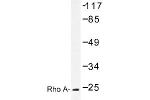 Image no. 1 for anti-Ras Homolog Gene Family, Member A (RHOA) antibody (ABIN272117) (RHOA anticorps)
