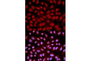 Immunofluorescence analysis of U2OS cell using NFATC1 antibody.