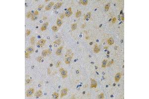 Immunohistochemistry of paraffin-embedded rat brain using IGFBP4 Antibody.
