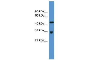 Pdyn antibody used at 0. (PDYN anticorps  (Middle Region))
