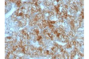 Image no. 1 for anti-Cadherin-16 (CDH16) antibody (ABIN6182923) (Cadherin-16 anticorps)