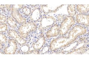 Detection of Arg2 in Human Kidney Tissue using Monoclonal Antibody to Arginase II (Arg2)