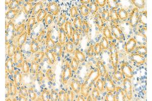 ABIN6261431 and ABIN6279416 at 1/100 staining Rat kidney tissue by IHC-P. (EDEM3 anticorps  (C-Term))