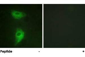 Immunofluorescence analysis of HeLa cells, using IGF2R polyclonal antibody . (IGF2R anticorps)