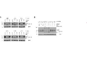 Immunoblot Analysis using ABIN135046.
