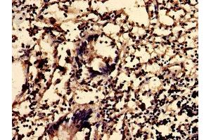 IHC image of ABIN7163135 diluted at 1:600 and staining in paraffin-embedded human appendix tissue performed on a Leica BondTM system. (Sphingomyelin Synthase 2 anticorps  (AA 1-79))