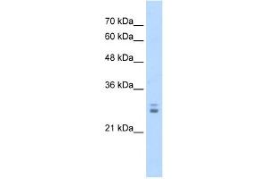 KCTD11 antibody used at 1.