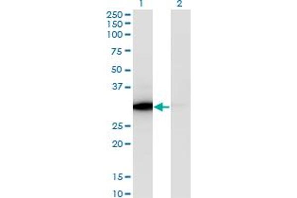 ATP6V1E1 anticorps  (AA 1-226)
