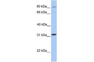 ELFN2 antibody used at 1 ug/ml to detect target protein. (ELFN2 anticorps  (N-Term))