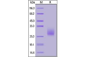 Biotinylated Mouse CTLA-4, His,Avitag on  under reducing (R) condition.
