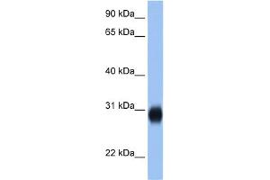WB Suggested Anti-RAB3D Antibody Titration:  2. (RAB3D anticorps  (C-Term))