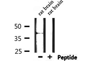 Western blot analysis of extracts from rat brain, using MT-CYB Antibody. (Cytochrome b anticorps  (N-Term))