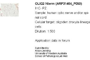 Sample Type: Human Optic Nerve and Spinal CordCellular Target: Oligoden Drocyte Lineage CellsDilution: 1:500 (OLIG2 anticorps  (N-Term))