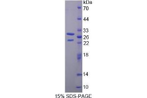 Image no. 1 for BMX Non-Receptor Tyrosine Kinase (BMX) (AA 287-523) protein (His tag) (ABIN6238216) (BMX Protein (AA 287-523) (His tag))