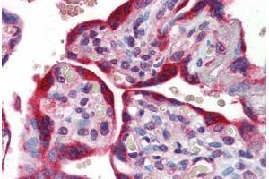 Human Placenta: Formalin-Fixed, Paraffin-Embedded (FFPE)