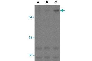 Western blot analysis of ANTXR1 in K-562 cell lysates with ANTXR1 polyclonal antibody  at (A) 0. (ANTXR1 anticorps)