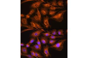 Immunofluorescence analysis of C6 cells using Apolipoprotein  Rabbit pAb (ABIN7265634) at dilution of 1:100.