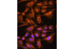 Immunofluorescence analysis of C6 cells using Apolipoprotein  Rabbit pAb (ABIN7265634) at dilution of 1:100. (APOA2 anticorps  (AA 1-100))