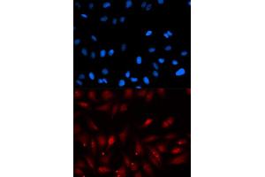 Immunofluorescence analysis of U2OS cells using PA2G4 antibody (ABIN5973112). (PA2G4 anticorps)