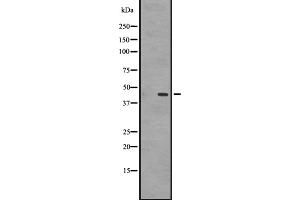 Western blot analysis of GPR87/GPR95 expression in A431 whole cell lysate ,The lane on the left is treated with the antigen-specific peptide. (GPR87 anticorps  (C-Term))