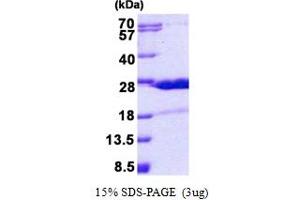 SDS-PAGE (SDS) image for Hematological and Neurological Expressed 1 (HN1) (AA 1-154) protein (His tag) (ABIN7280227)