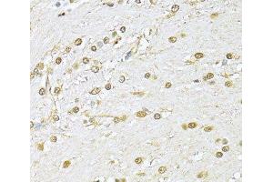 Immunohistochemistry of paraffin-embedded Rat brain using KU70 Polyclonal Antibody at dilution of 1:100 (40x lens).