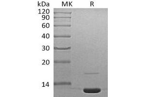 Western Blotting (WB) image for Complement Component 3 (C3) protein (ABIN7320494) (C3 Protéine)