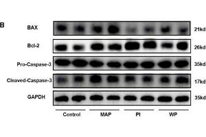 The influence of intra-peritoneal injections PAAF with or without the PI3K inhibitor on PI3K/AKT signaling pathway.