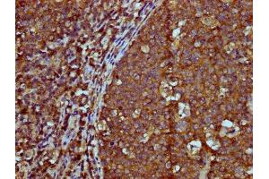 IHC image of ABIN7156089 diluted at 1:600 and staining in paraffin-embedded human tonsil tissue performed on a Leica BondTM system. (IGHM anticorps  (AA 45-178))