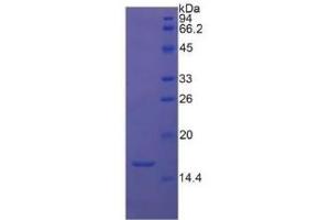 SDS-PAGE of Protein Standard from the Kit (Highly purified E. (TGFB1 Kit CLIA)
