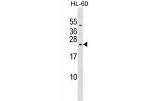 Western Blotting (WB) image for anti-Ribosomal Protein L10L (RPL10L) antibody (ABIN2999579) (RPL10L anticorps)