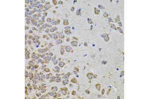 Immunohistochemistry of paraffin-embedded mouse brain using PIK3CA antibody (ABIN5970095) at dilution of 1/100 (40x lens). (PIK3CA anticorps)