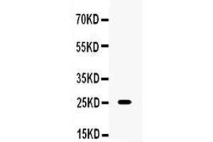 Western blot analysis of TNF alpha using anti-TNF alpha antibody .