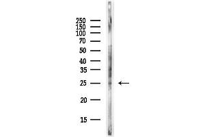 anti-Glutathione S-Transferase kappa 1 (GSTK1) (C-Term) antibody
