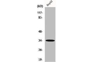 Western Blot analysis of HepG2 cells using Chemokine Receptor D6 Polyclonal Antibody (CCBP2 anticorps  (C-Term))