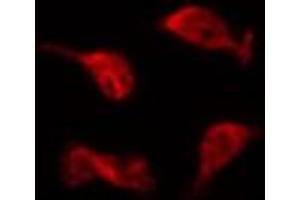 ABIN6274682 staining HepG2 by IF/ICC. (DCC anticorps  (C-Term))