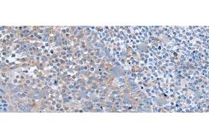 Immunohistochemistry of paraffin-embedded Human tonsil tissue using ZIC1 Polyclonal Antibody at dilution of 1:65(x200) (ZIC1 anticorps)
