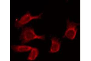 ABIN6269178 staining COS7 by IF/ICC. (GABA-RB anticorps)