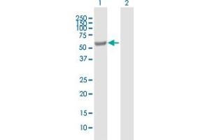 Western Blot analysis of EPHX2 expression in transfected 293T cell line by EPHX2 MaxPab polyclonal antibody.