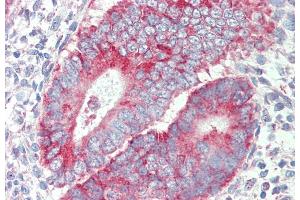 ABIN987282 (5 μg/mL) staining of paraffin embedded Human Uterus.