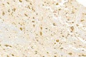 Immunohistochemistry analysis of paraffin-embedded rat spinal cord using ADAMTS4 (ABIN7072947) at dilution of 1: 3000