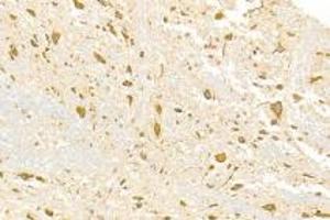 Immunohistochemistry analysis of paraffin-embedded rat spinal cord using ADAMTS4 (ABIN7072947) at dilution of 1: 3000 (ADAMTS4 anticorps)