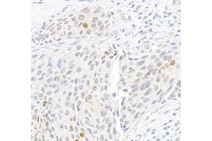 anti-gamma Histone Variant H2AX (GAMMA-H2AX) (Ser139) antibody