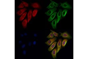 ABIN6262409 and ABIN6276925 staining Hela cells by IF/ICC. (HSPA1L anticorps  (Internal Region))