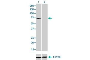 Western Blotting (WB) image for anti-Myotubularin 1 (MTM1) (AA 1-100) antibody (ABIN598823) (MTM1 anticorps  (AA 1-100))