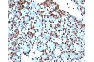 IHC staining of rat pancreas with SUMO1 antibody (clone S1MT-2).
