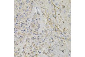Immunohistochemistry of paraffin-embedded mouse brain using REG3A antibody (ABIN6132545, ABIN6146855, ABIN6146856 and ABIN6216122) (40x lens). (REG3A anticorps  (AA 27-175))