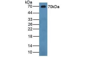 Detection of CHGB in Human Serum using Polyclonal Antibody to Chromogranin B (CHGB) (CHGB anticorps  (AA 496-669))