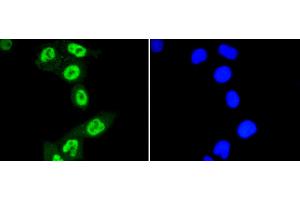 HeLa cells were fixed in paraformaldehyde, permeabilized with 0.